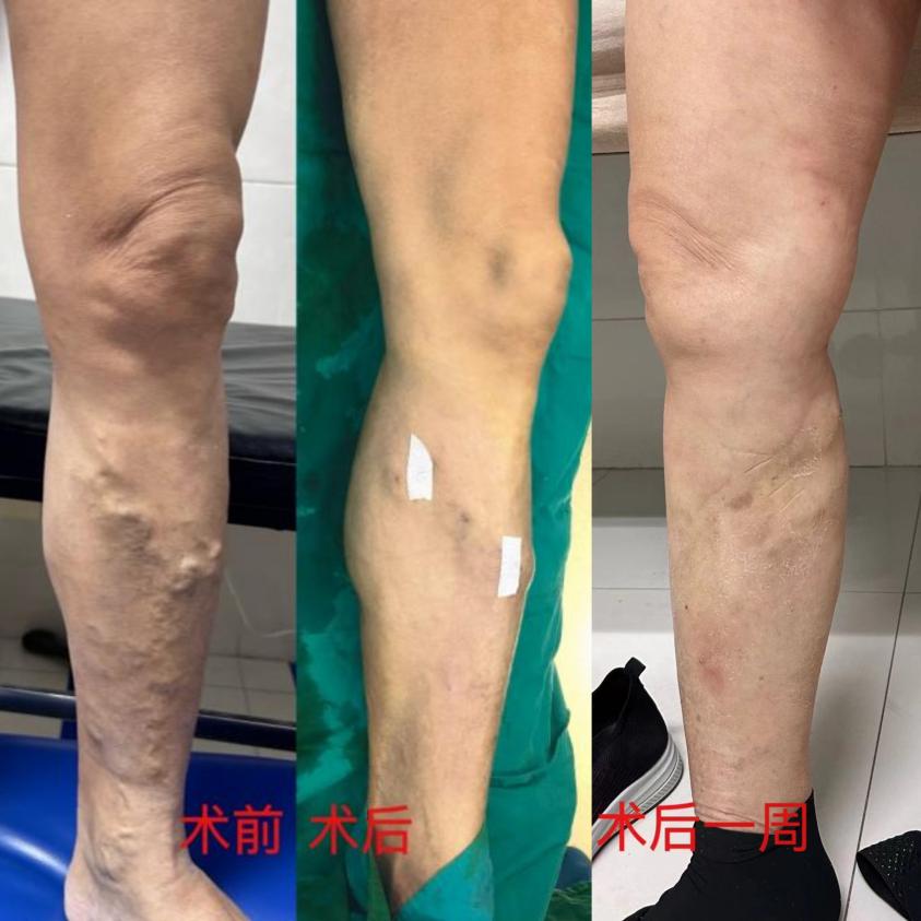 ac6c6a2c69c5678f1bbdaf4060c3f9c